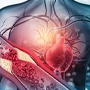 قلب و عروق